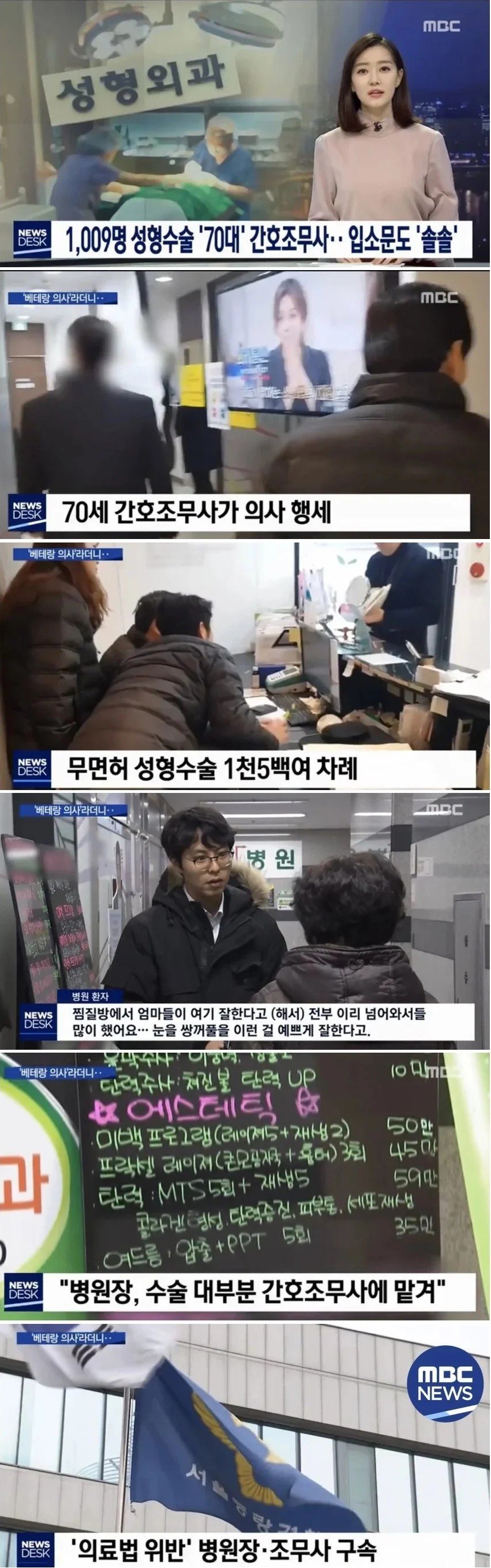 70대 간호조무사가 1500건 대리수술