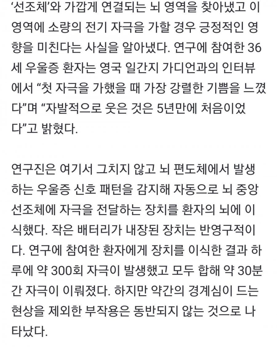 뇌에 전기충격을 가하면